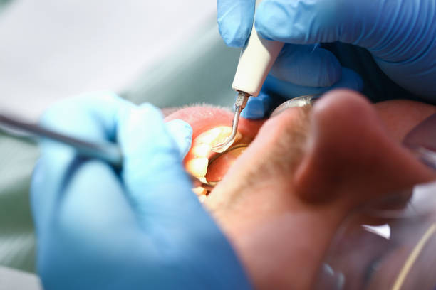 Best Pediatric Emergency Dentist in Hooverson Heights, WV