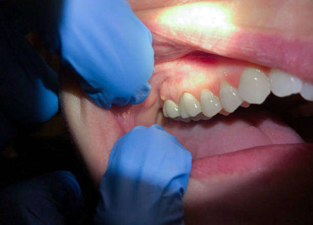  Hooverson Heights, WV Emergency Dentist Pros