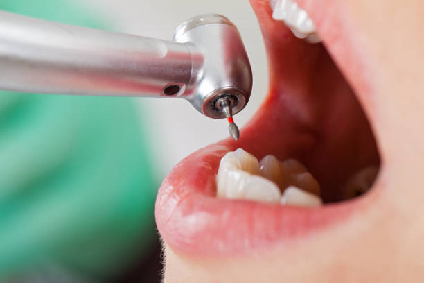 Best Emergency Root Canal Treatment in Hooverson Heights, WV